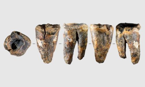 Štúdia zistila, že prvý známy zubár bol v skutočnosti neandertálec