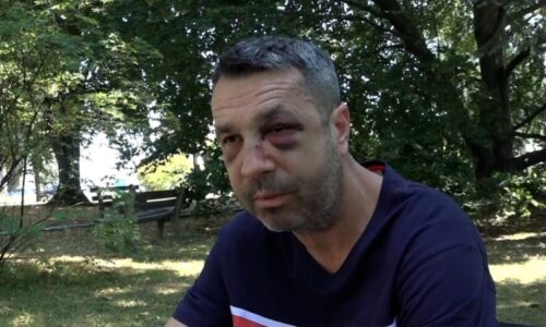 Přeražený nos a zlomená očnice: Surové napadení natočila kamera, už ho šetří slovenská policie